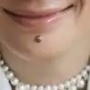 痣慧