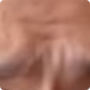 wrinkles